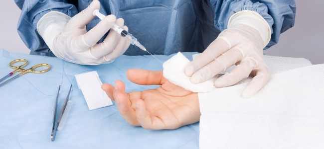 Hysterectomy Surgical Procedure