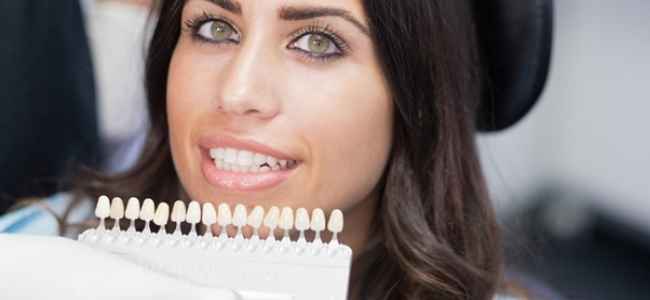7 Awesome Benefits of Dental Veneers