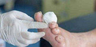 All You Have to Know About Diabetic Ulcers All You Have to Know About Diabetic Ulcers