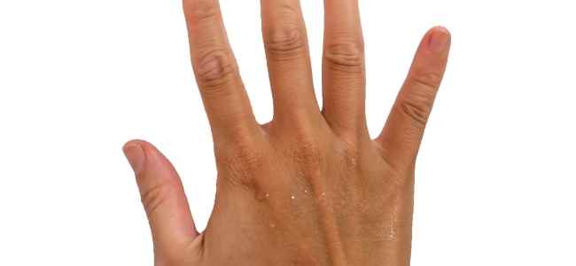 Alleviate Rheumatoid Arthritis Symptoms with These Effective Remedies
