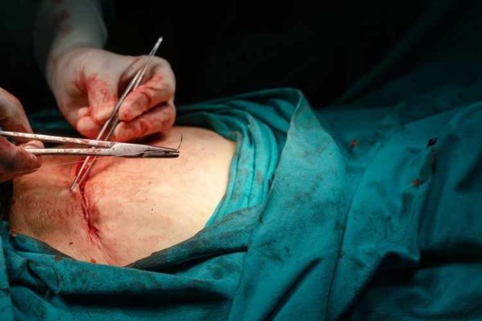 Hysterectomy surgery