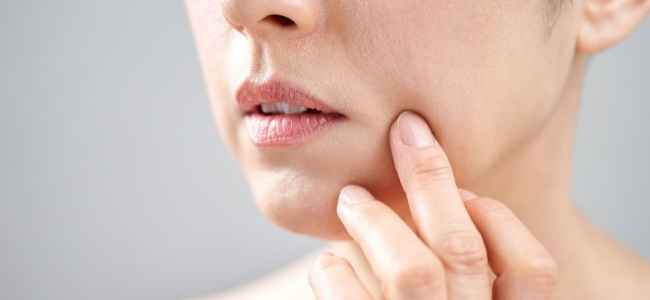 The Causes of Nasolabial Folds and How to Treat Them