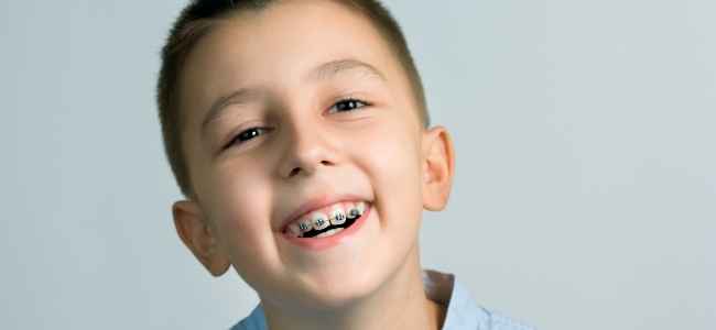 Get Your Child Custom Braces in Santa Clarita