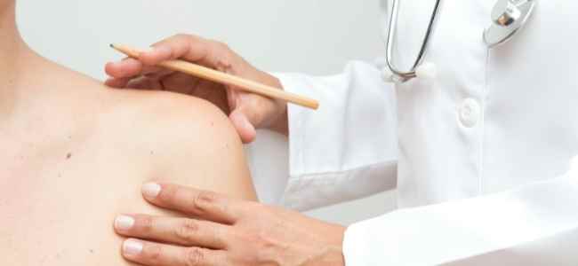 Everything you ought to know about skin cancer screening