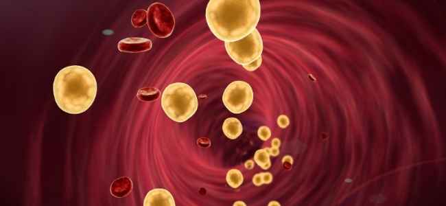 Why you Should Manage your Cholesterol Levels
