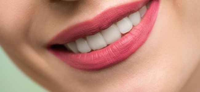 Role of Veneers in Improving Your Smile