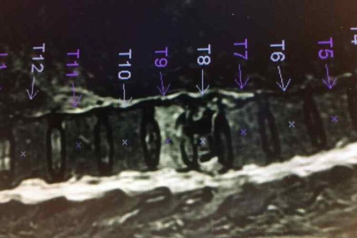 Thoracic Conditions