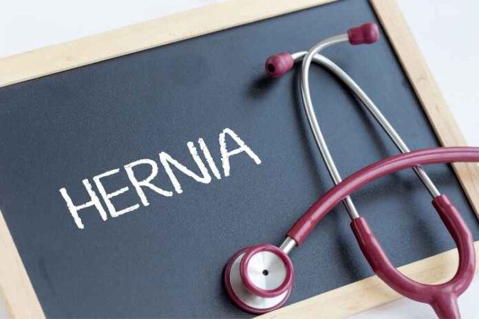 What Should You Know About Hernias
